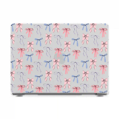 Coquette Girlie | Pastel Bows Laptop Shell