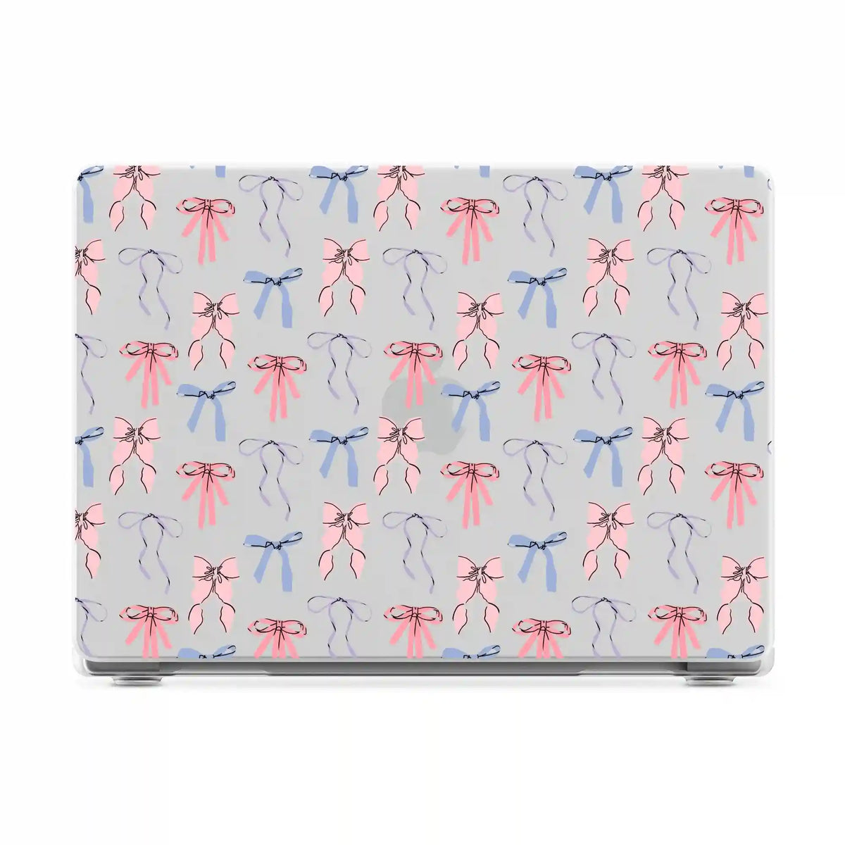 Coquette Girlie | Pastel Bows Laptop Shell