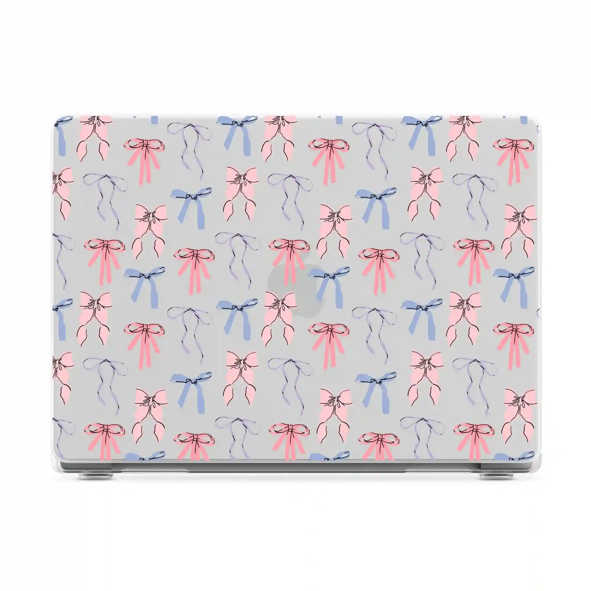 Coquette Girlie | Pastel Bows Laptop Shell